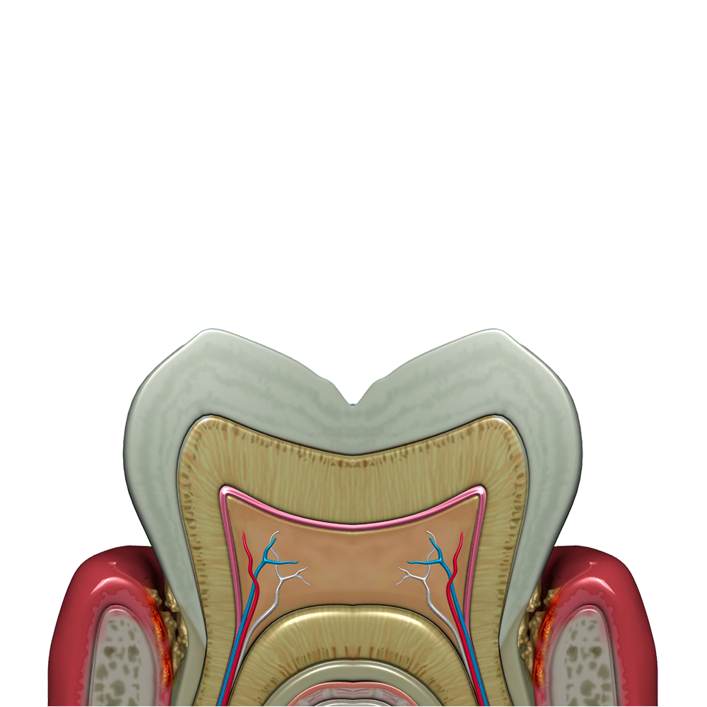 Bacteria in the periodontal pocket