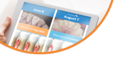 GumScore-Tablet2 GumScore-Tablet2